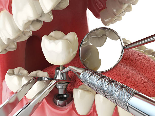Best Mobile Emergency Dentist in Siler City, NC