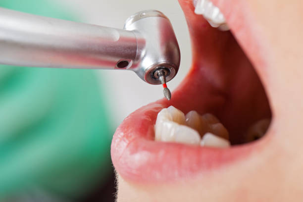 Best Emergency Root Canal Treatment in Siler City, NC